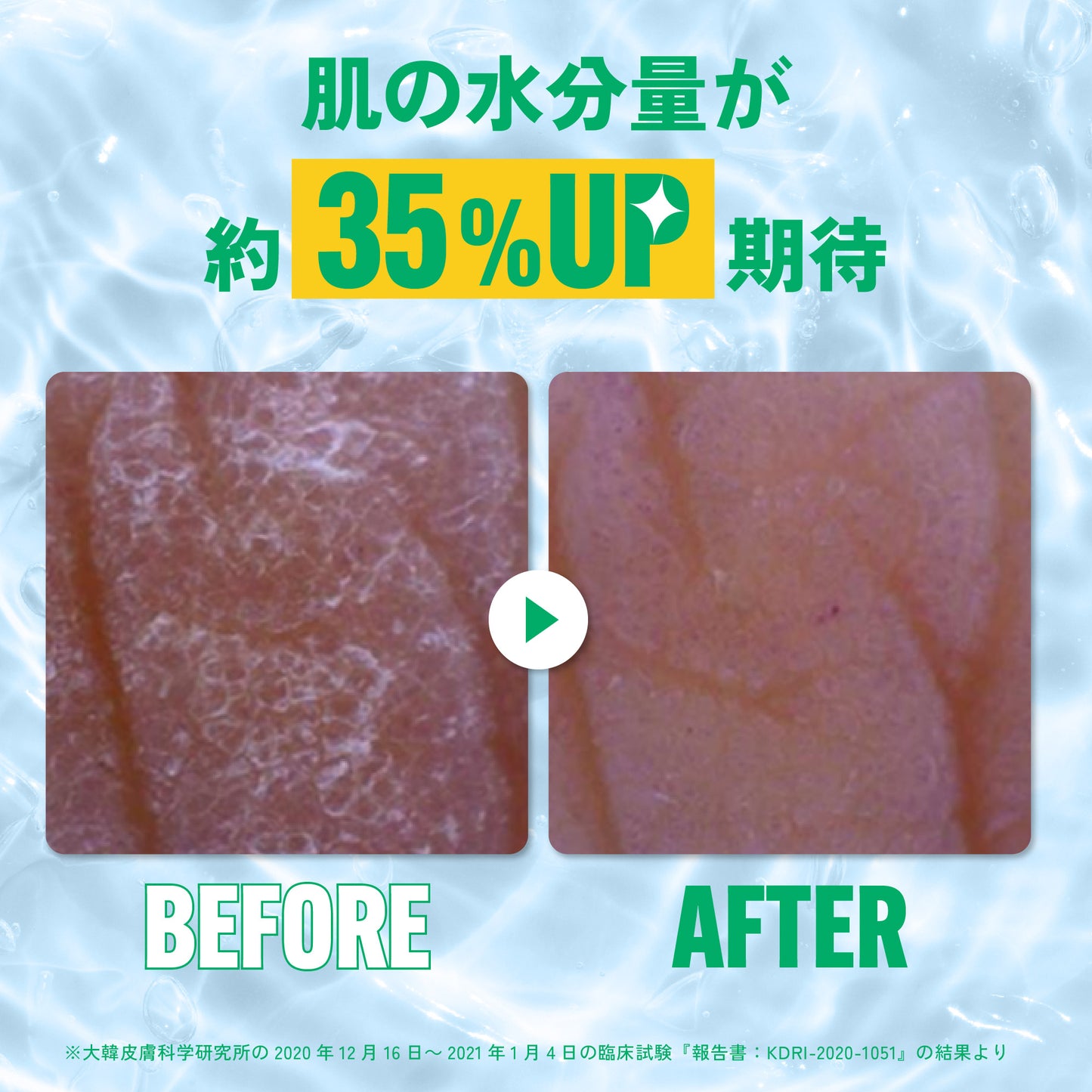 【33%OFF】Mom's Bath Recipe ボディピーリングパッド オリジナル 8枚セット｜韓国アカスリ マムズバスレシピ 韓国コスメ